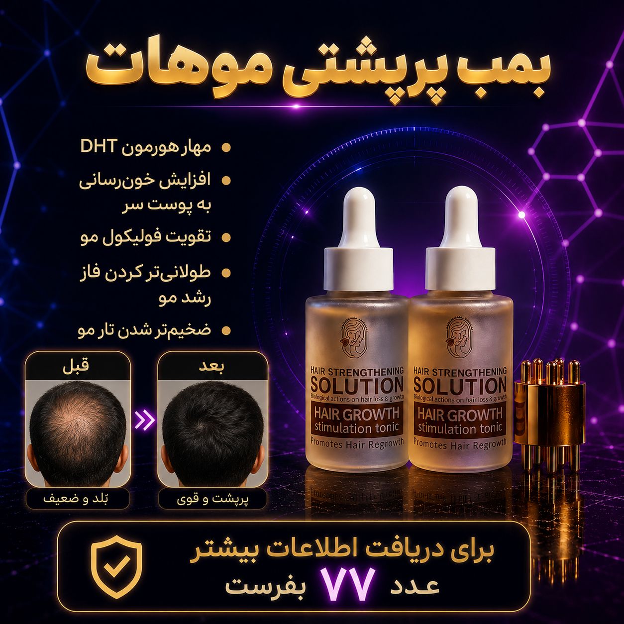 تونیک اکسونیک همراه با اپلیکاتور، توقف و ضد ریزش مو  _ پرپشت کردن مو  و محرک رشد مو وتغذیه ساقه و پیاز مو - کاملاا اصل تضمینی، ارسال ازنمایندگی